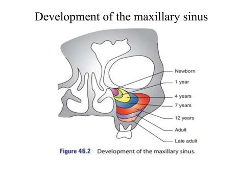 Development, Anatomy and Histology of Maxillary Sinus.pptx