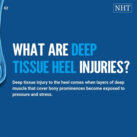 Image result for Deep Tissue Injuries