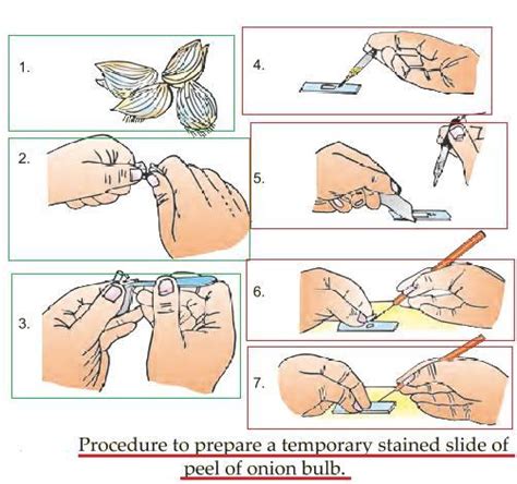 stain used to observe nucleus in onion peel______? - Brainly.in