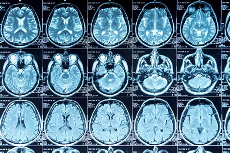 How Much Does An Mri Cost In Massachusetts at Emma Gresswell blog