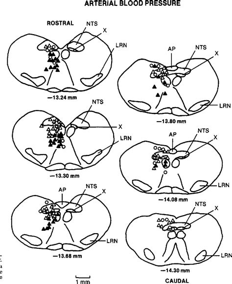 Figure 1 from Characterization of antinociception produced by glutamate microinjection in the ...