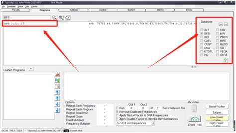 Image result for Spooky2 Biofeedback Scan