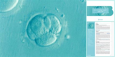 AQA GCSE Cell Biology Lesson 7: Stem Cells | Beyond - Twinkl