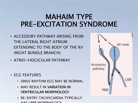 Pre Excitation Syndrome