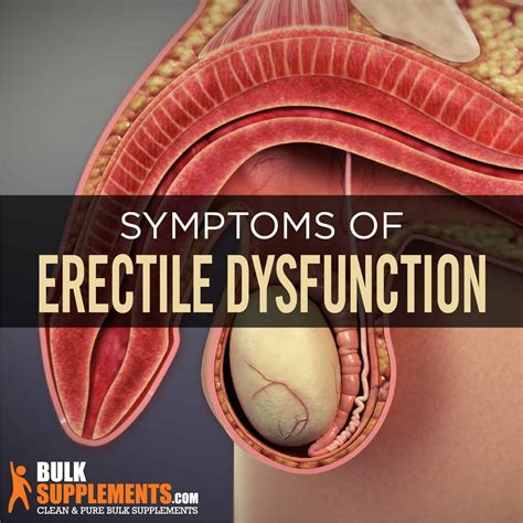 Erectile Dysfunction (ED): Symptoms, Causes Treatment, 43% OFF