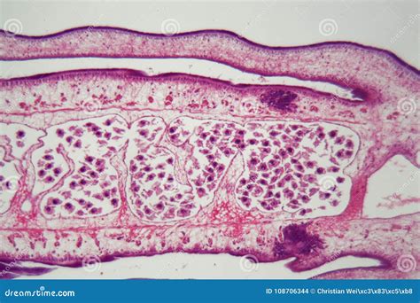 Segment of a Tapeworm Body Proglottid Stock Photo - Image of parasites ...