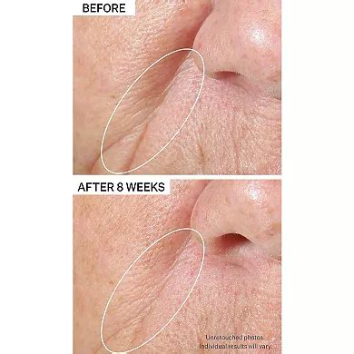 StriVectin Peptight Tightening & Brightening Face Serum