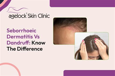How to Prevent Razor Bumps: The Ultimate Dermatologist Approved Guide - Agelock Skin & Hair Clinic