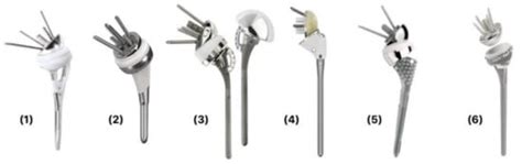 Prosthesis Designs and Tuberosity Fixation Techniques in Reverse Total ...