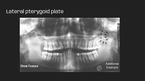 PANORAMIC RADIOGRAPHS .pdf