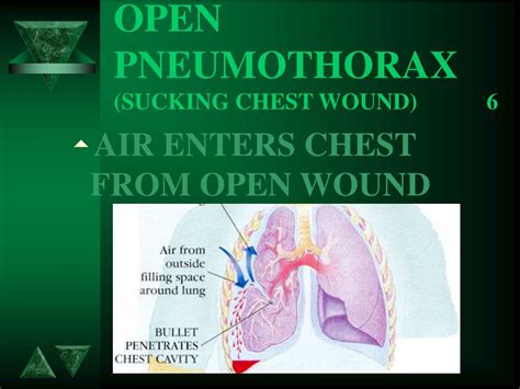 PPT - HEAD / CHEST ABDOMINAL INJURIES PowerPoint Presentation, free ...