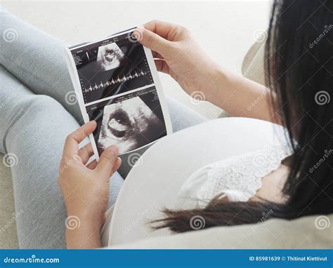 Pregnant Woman Holding Ultrasound Scan. Stock Image - Image of mother ...