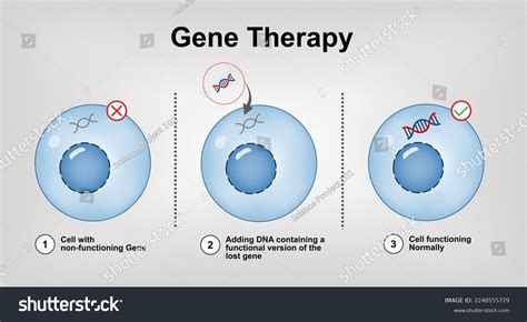 Gene Therapy 的图像结果