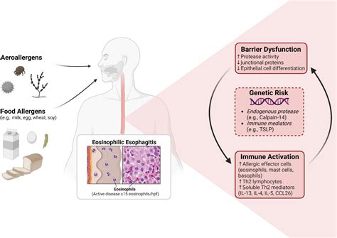 Breaking down the complex pathophysiology of eosinophilic esophagitis - Annals of Allergy ...