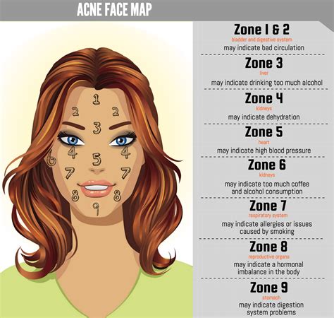 Acne face map what does acne pimples on your cheeks forehead jawline t zone left cheek etc mean ...