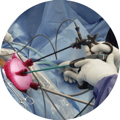 V Notes Procedure 的图像结果