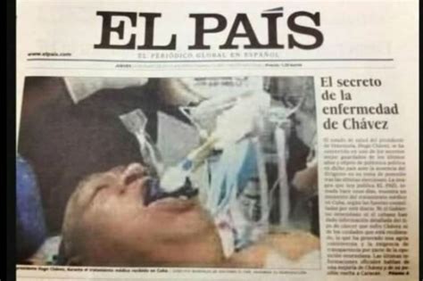 Foto que publicó diario español de Hugo Chávez intubado es falsa | EL ...