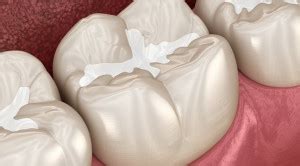 Artikel Terkait - Alomedika