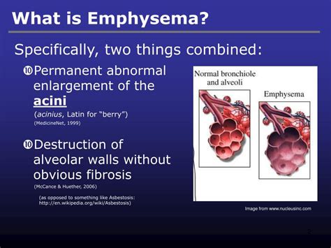 Image result for Emphysema Example