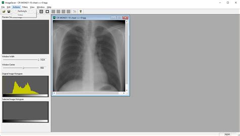 Load File DICOM Viewer 的图像结果