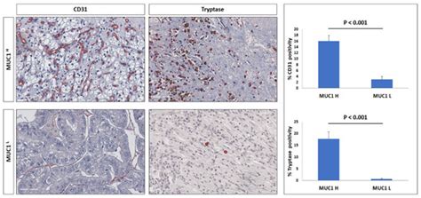 MUC1 Expression Affects the Immunoflogosis in Renal Cell Carcinoma ...