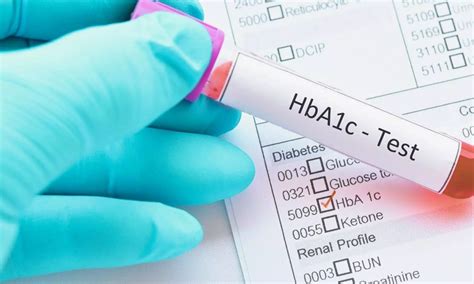 High A1c Variability Linked to Increased Mortality in Diabetes, reveals ...