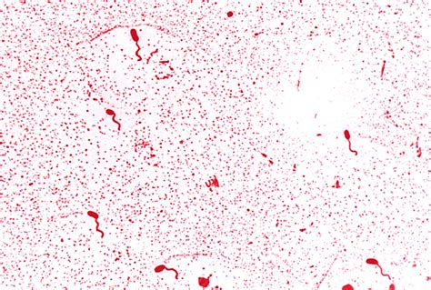 Vibrio - wikidoc