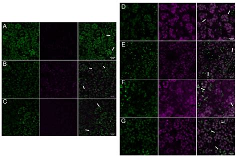 Arabidopsis PII Proteins Form Characteristic Foci in Chloroplasts ...