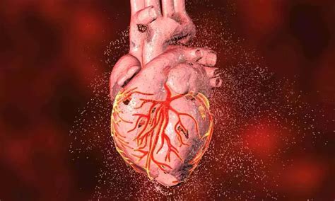 Former and current use of abacavir linked to higher incidence of MACE ...