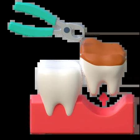 Broken Tooth Extraction Design Assets – IconScout