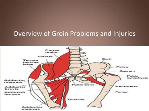PPT - Groin Injuries And Problems PowerPoint Presentation, free ...