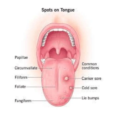 Your Guide on How to Get Rid of Bump on Tongue - Smile Studio Boston