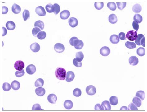 Staining-Independent Malaria Parasite Detection and Life Stage ...