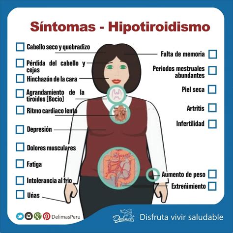 Como Se Cuando Tengo Hipotiroidismo Sintomas