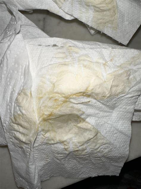 Yellowish Discharge During Pregnancy Yellow Discharge In Pregnancy: