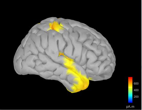 Image result for EEG Source Localization