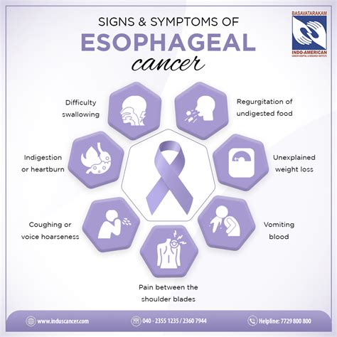Esophageal Cancer Diagram