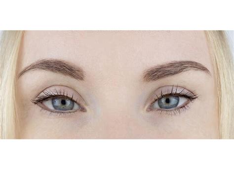 Image result for Thread Lift Problems