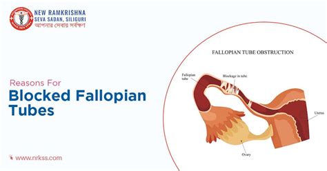 Image result for Fallopian Tube Blockage Surgery