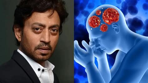 न्यूरोएंडोक्राइन कैंसर से अभिनेता इरफान खान की हुई थी मौत, जानें क्या ...