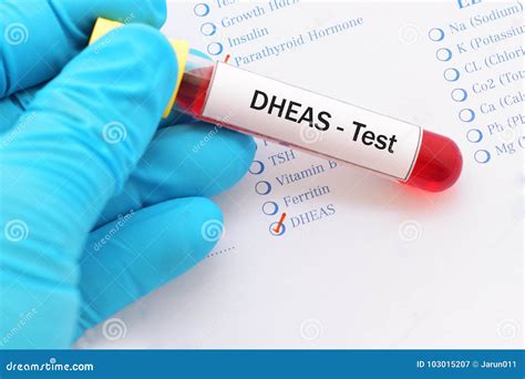DHEAS test stock image. Image of androsterone, medicine - 103015207