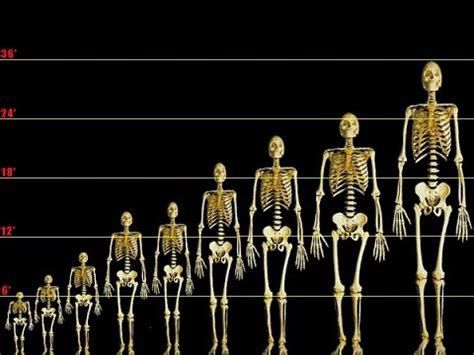 Image result for Skeleton Brain Exploding