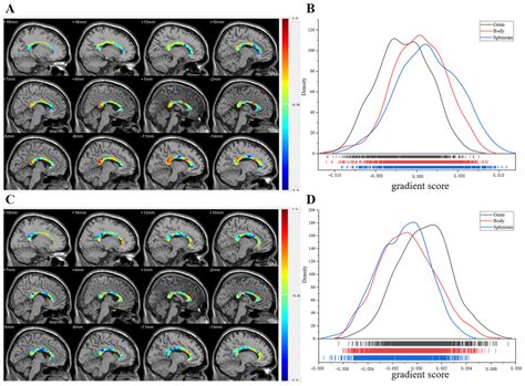 White Matter-Gray Matter Correlation Analysis Based on White Matter ...