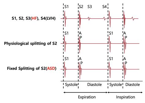 Heart Sound | 메디톡