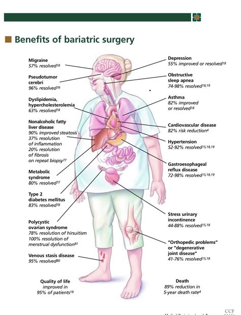 The big gastric bypass diet guide – Artofit