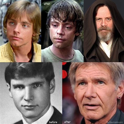 List 104+ Pictures Mark Hamill Before And After Car Accident Photos ...