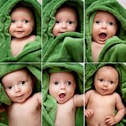 Image result for Newborn Herniated Belly Button