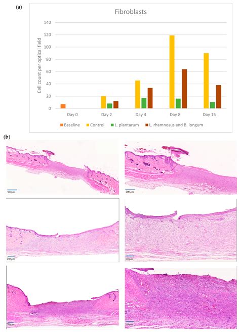 L. plantarum UBLP-40 Versus the Combined Formula of L. rhamnosus UBLP ...