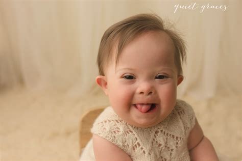 Down Syndrome Newborn