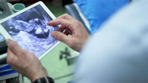 Image result for Reproduction Examination